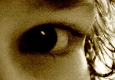 Eye
